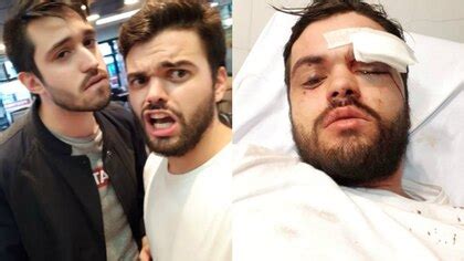 Los Vamos A Encontrar Van A Pagar Por Lo Que Le Hicieron Dijo Un Amigo Del Rugbier Gay Que