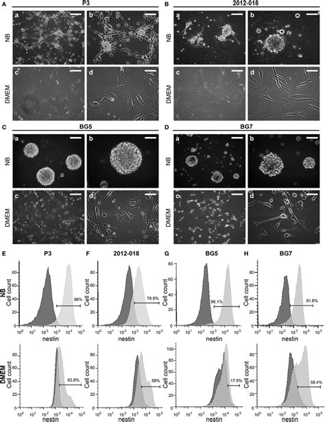 Culture Medium Impacts Patient Derived Glioblastoma GBM Cells