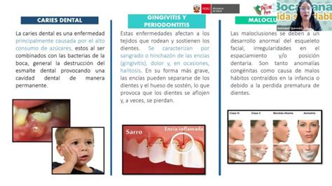 La Importancia De La Higiene Oral En Niños Actualizado Enero 2025