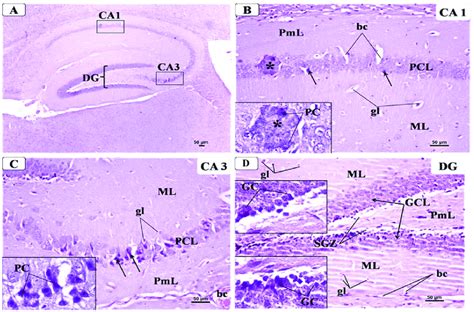 Representative photomicrographs of H&E-stained brain sections showing ...