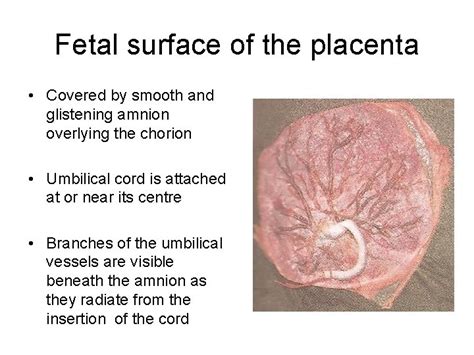 Placenta And Amniotic Fluid Structure Function And Abnormalities