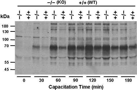 Pcsk Null Sperm Display Enhanced Protein Tyrosine Phosphorylation And