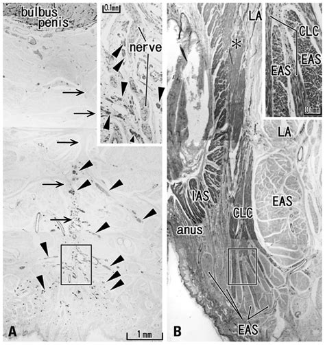 Longitudinal Anal Muscles In A Male Week Fetus Frontal Sections