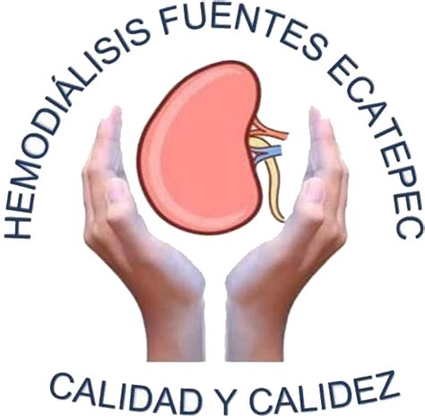 Catéter De Hemodiálisis Todo Lo Que Debes Saber Hemodiálisis Fuentes Ecatepec