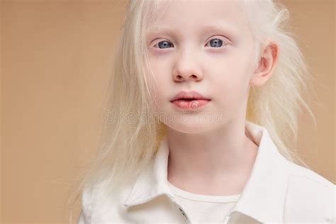 25,600 Albino Stock Photos - Free & Royalty-Free Stock Photos from ...