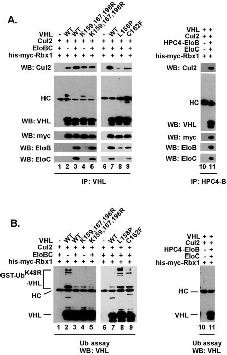 The VHL protein is protected from ubiquitylation in the context of the ...