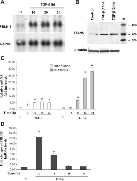 Figure 1 From Fibulin 5 Gene Expression In Human Lung Fibroblasts Is