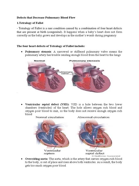 Tetraogy Of Fallot Pdf Heart Congenital Heart Defect