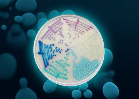 chromagar   widest range  chromogenic media