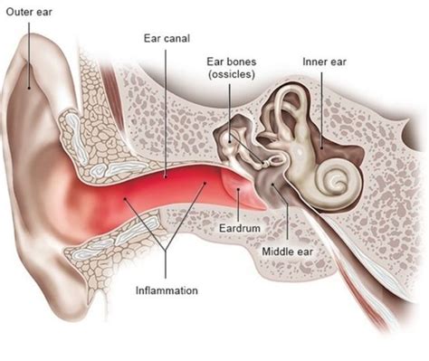 A Guide To External Ear Infections From An Ent Specialist In Singapore