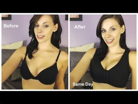 Boob Job Vlog Day Of Surgery Post Op YouTube