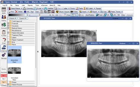 Open Dental Software Imaging Module