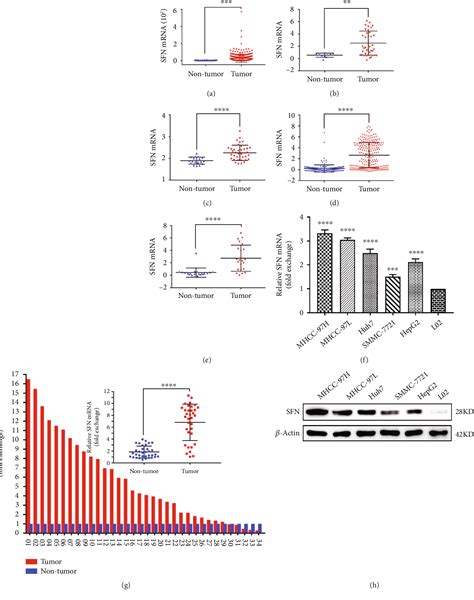 Figure From Stratifin Promotes Hepatocellular Carcinoma Progression