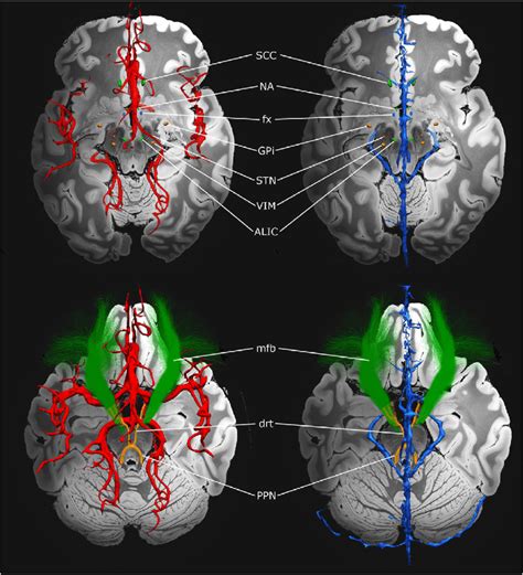 Neuroanatomical Relationships Between Commonly Employed Dbs Targets And