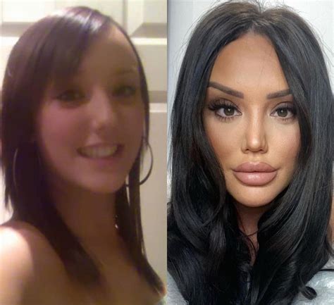 Geordie Shore Cosmetic Surgery Transformations - BuzzPopDaily