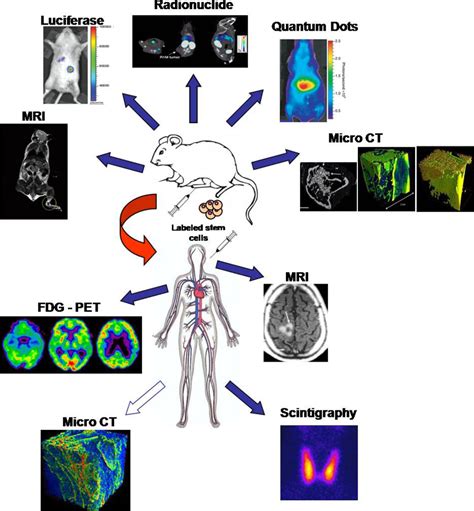 IJMS Free Full Text Stem Cell Tracking By Nanotechnologies