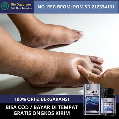 Jual Obat Kaki Bengkak Diabetes Asam Urat Jantung Ginjal Obat