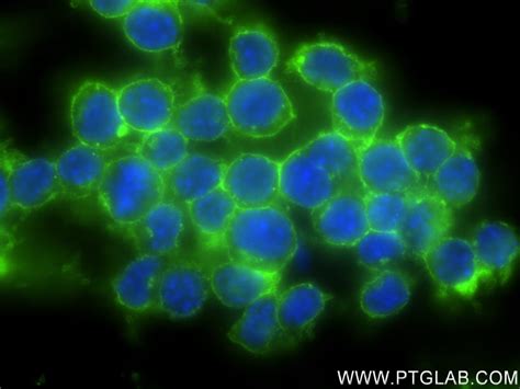 CD45 antibody (83396-5-RR) | Proteintech