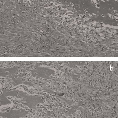 Histopathological findings of the resected specimen. (a) Fibroblastic ...