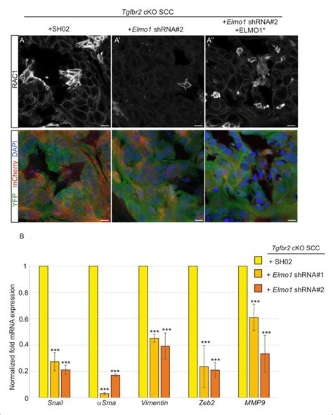 Knockdown of Elmo1 diminishes RAC1 expression and markers of invasion ...
