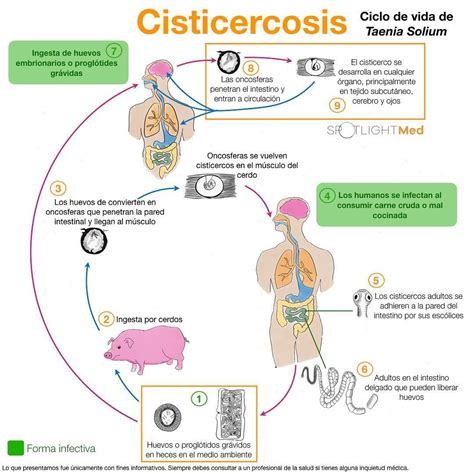 Ciclo De Vida Taenia Solium Cisticercosis Spotlightmed