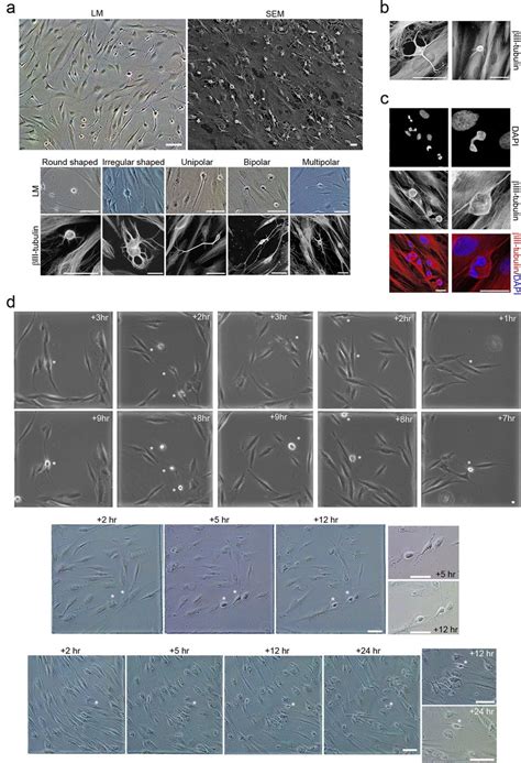 Morphological Changes In HPDLSCs Cultures During Neural Induction A