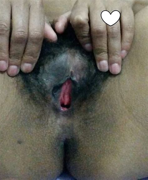 Bucetas E Xanas Vagina Porn Pictures XXX Photos Sex Images PICTOA