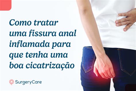 Como tratar uma fissura anal para que tenha uma boa cicatrização