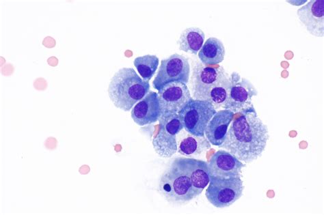 Macrophage