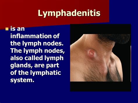 Acute Purulent Infections Of Soft Tissues A Boil