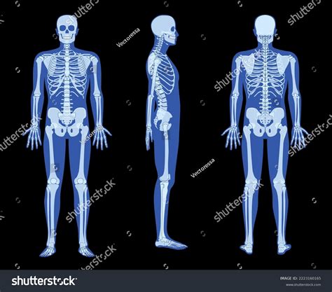 1,493 Hand X Ray Cartoon Images, Stock Photos & Vectors | Shutterstock