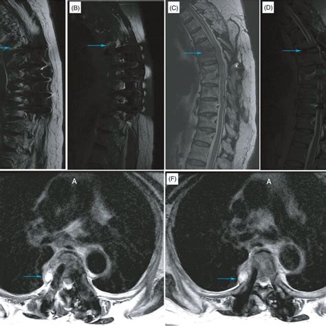 Preoperative And Postoperative Xray Examinations During The Second