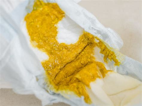 Baby poop: Pictures of healthy and unhealthy stools | Baby pooping