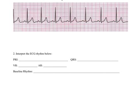 Solved Interpret The Ecg Rhythm Below Pri Chegg