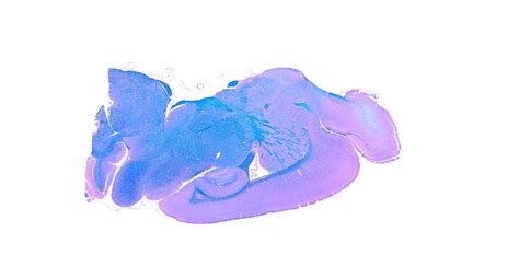 Luxol Fast Blue Stain