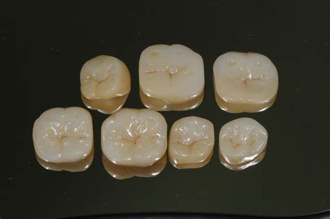 Services Porcelain Crowns Brisbane Prosthodontics