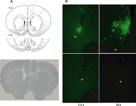 ΔFosB in the Nucleus Accumbens Regulates Food Reinforced Instrumental