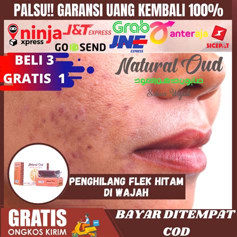 Jual Sabun Cuci Muka Penghilang Flek Hitam Di Wajah Flek Hitam