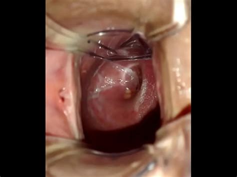 Dentro del coño con espéculo vaginal XVIDEOS