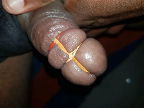 Rubber Bands On My Glans Nude Pics XHamster