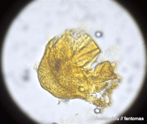 Пыльца поврежденная - СПК