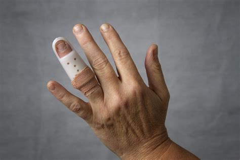 Dislocated Finger What To Do Plus Symptoms Causes And Treatment