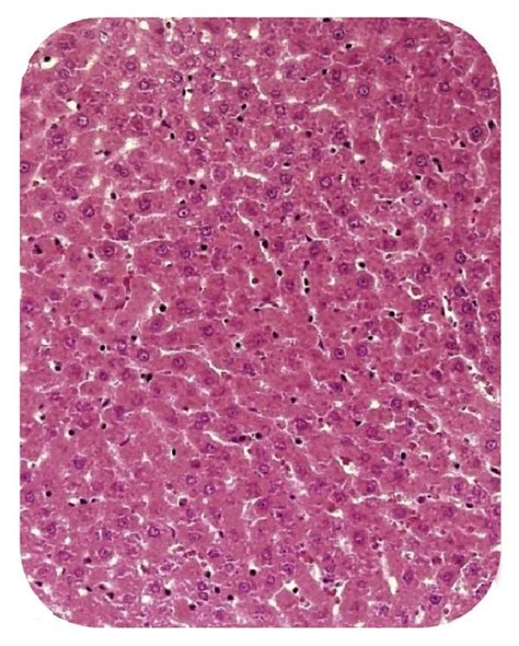 Light Micrograph Of Liver Cell In Different Groups A Normal Liver Download Scientific