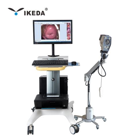 Supply Digital Video Colposcope Equipment For Cervix Vagina Examination Factory Quotes OEM