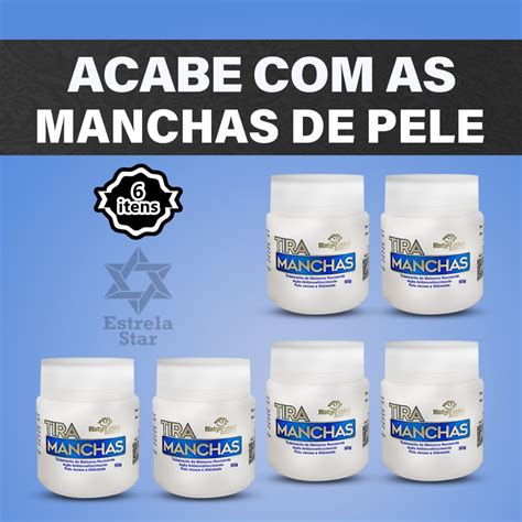 Kit Com 6 Pomada Tira Manchas Natyflora Clareadora De Pele Para Rosto
