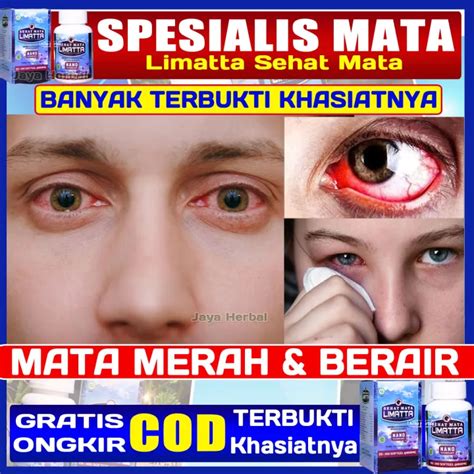 Obat Infeksi Mata Mata Berair Mata Merah And Perih Kadang Bengkak