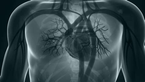 Human Xray Heart Anatomy Detail Stock Footage Video 100 Royalty Free