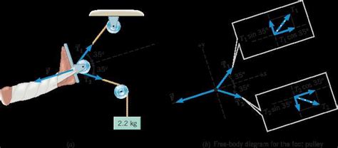 Examples of Free Body Diagrams for Pulleys
