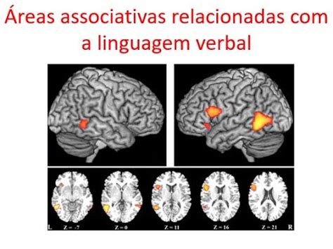 ÁREAS DA LINGUAGEM NO CÓRTEX CEREBRAL YouTube