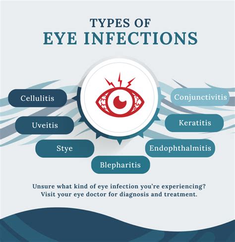 Types Of Eye Infections And How To Treat Them Calgary